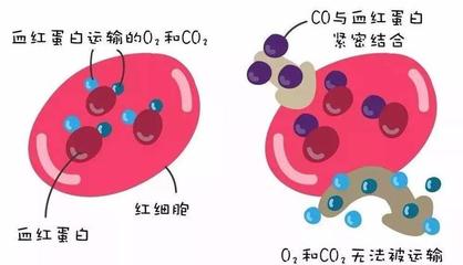 警惕洗澡季隱形殺手 一氧化碳中毒康復(fù)后，當(dāng)心遲發(fā)性腦病